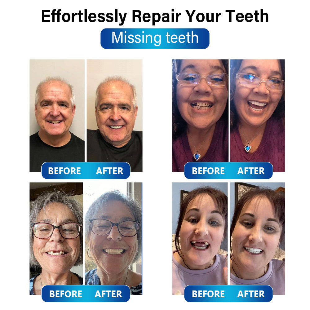 ✅Official Store | Bikenda™ Blue Light Curing Lamp And Dental Restoration Materials 🧑🏼⚕️FDA Approved (For repairing missing teeth, broken teeth, and gaps between teeth)