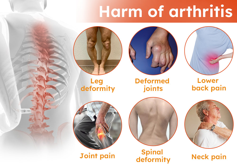 Furzero™ Turmeric Arthritis Cream (Neck & Back & Knee Relief)