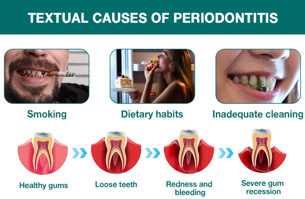 Furzero™ Coconut Oil Pulling (Treating oral ulcers, periodontitis)