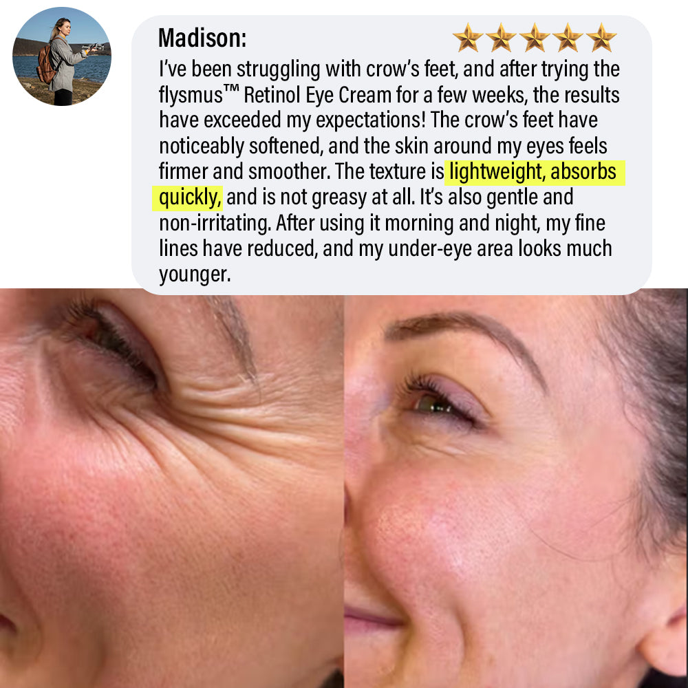 ✅Official Store | flysmus™ Retinol Eye Cream 🧑🏼⚕️Dermatologist Recommended (Eye Cream for Fine Lines, Wrinkles, Dark Circles, Dark Spots, and Daily Anti-Aging)