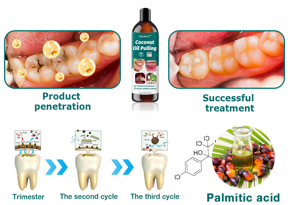 Furzero™ Coconut Oil Pulling (Treating oral ulcers, periodontitis)