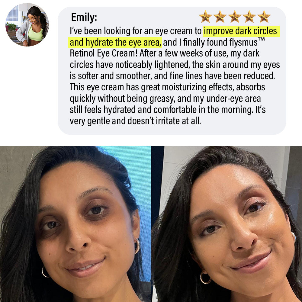 ✅Official Store | flysmus™ Retinol Eye Cream 🧑🏼⚕️Dermatologist Recommended (Eye Cream for Fine Lines, Wrinkles, Dark Circles, Dark Spots, and Daily Anti-Aging)
