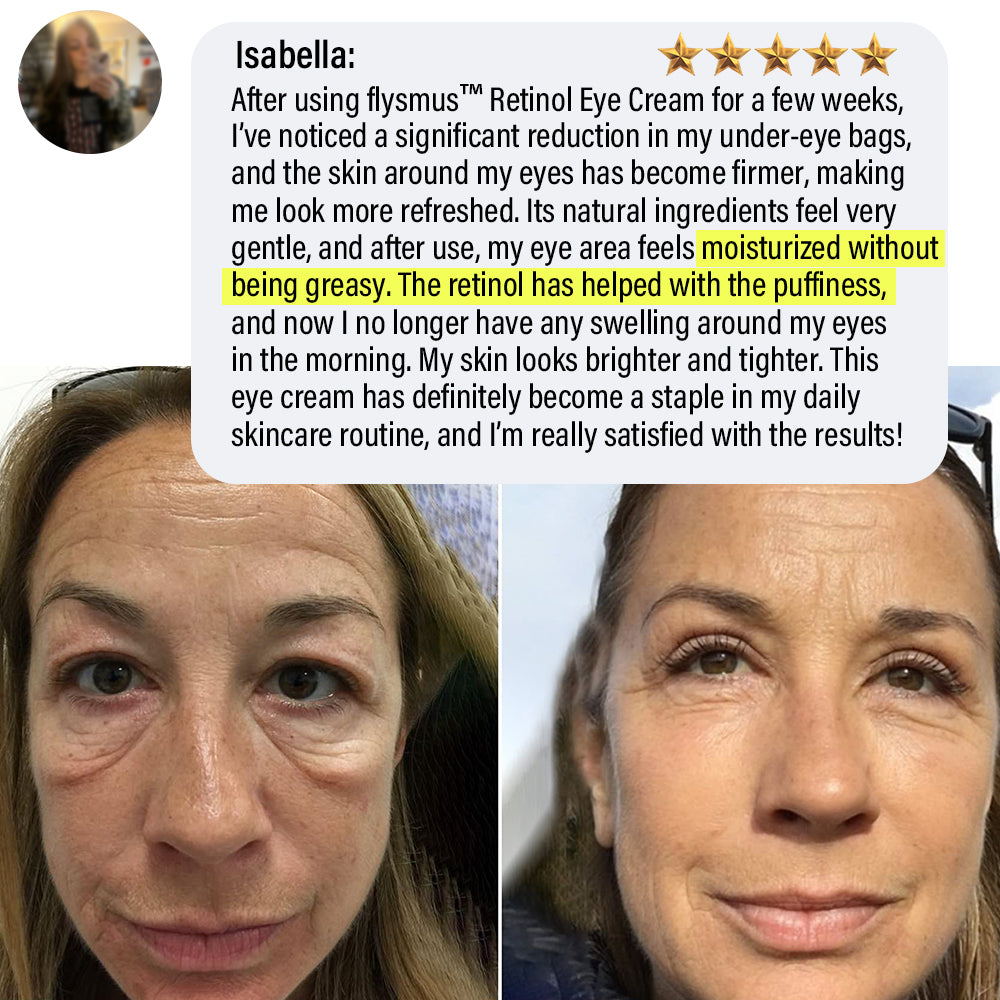 ✅Official Store | flysmus™ Retinol Eye Cream 🧑🏼⚕️Dermatologist Recommended (Eye Cream for Fine Lines, Wrinkles, Dark Circles, Dark Spots, and Daily Anti-Aging)