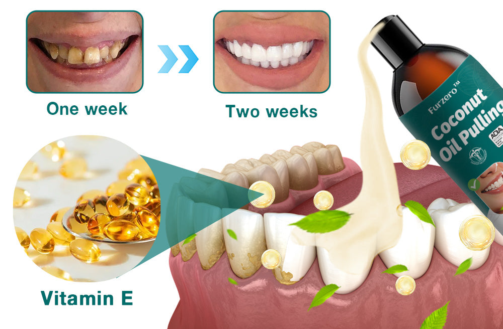 Furzero™ Coconut Oil Pulling (Treating oral ulcers, periodontitis)