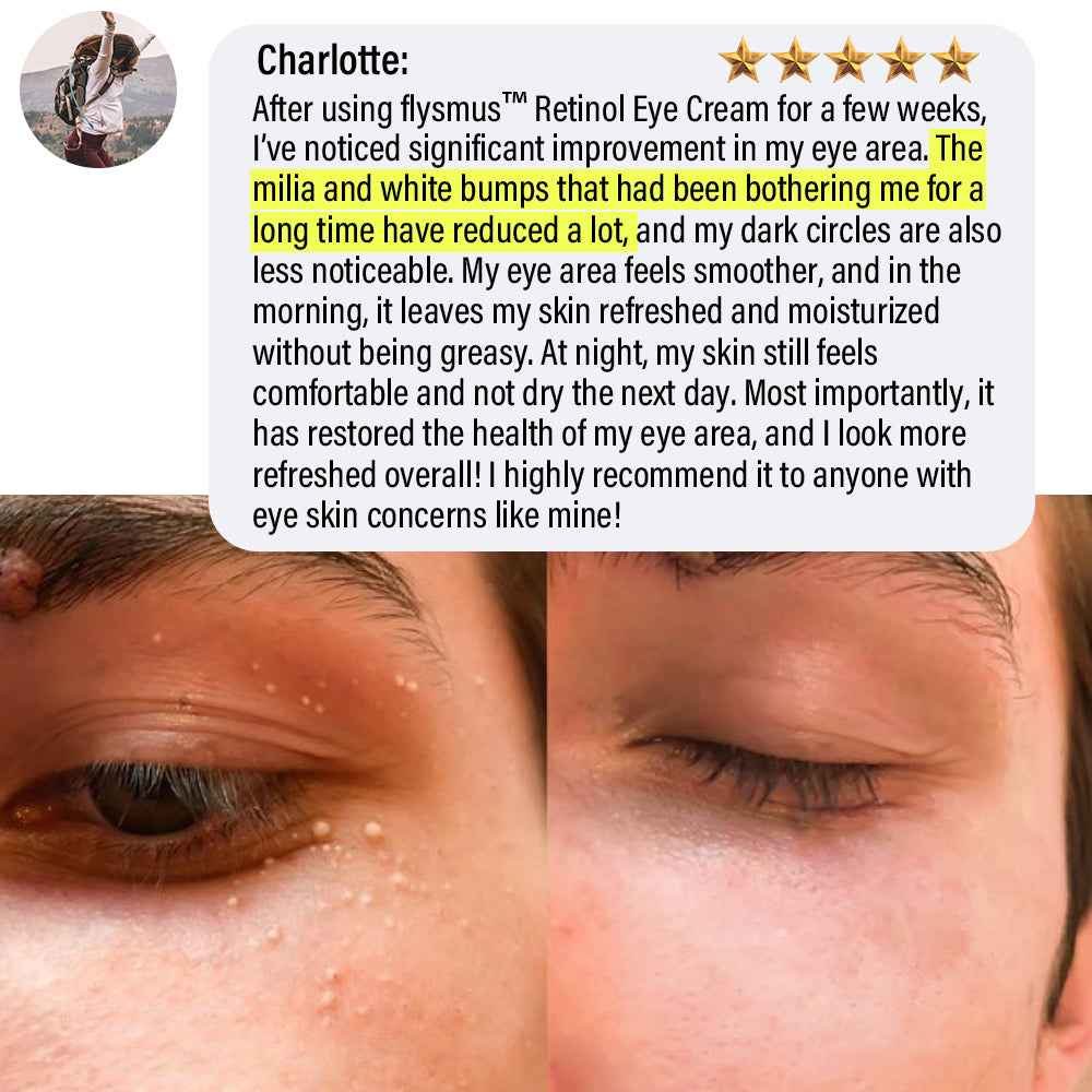 ✅Official Store | flysmus™ Retinol Eye Cream 🧑🏼⚕️Dermatologist Recommended (Eye Cream for Fine Lines, Wrinkles, Dark Circles, Dark Spots, and Daily Anti-Aging)